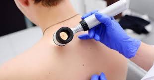 Щодо проведення заходів з нагоди Всеукраїнського Дня меланоми